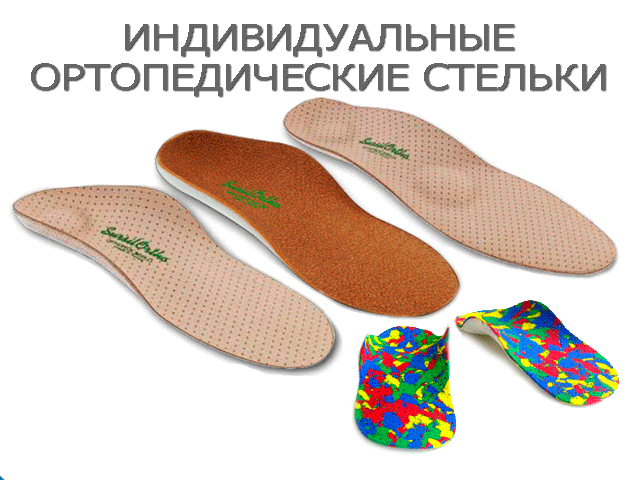 индивидуальные ортопедические стельки